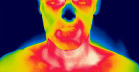 兩名BAT陽性受試者和(B)一名BAT陰性受試者在120分鐘冷卻前后的代表性PET-CT和紅外熱成像